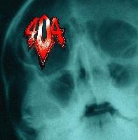 Picture for song 'Bite the Bush' by artist '404'