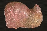 Picture for song 'AlCoHoLiC LiVeR' by artist 'Atypical Theme'