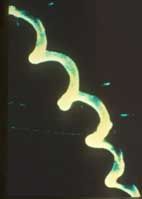 Picture for song 'Lloyd17-"Nitrogen Chuckwagon" boron jive leper mix' by artist 'boron jive leper'