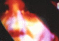 Picture for song 'crotchlaugh' by artist 'Cuticle'