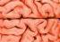 Picture for song 'Brains On Fire' by artist 'Deadly Little Things'