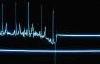 Picture for song 'da way to life(flatline mix)' by artist 'dEEpdARkTranCE'