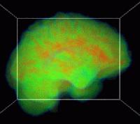 Picture for song '3 Minds Collide' by artist 'Die-Verse-It-T'