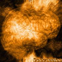 Picture for song 'Sundelin - Concussion (Orginal Mix)' by artist 'Dj puppet vs JeS'