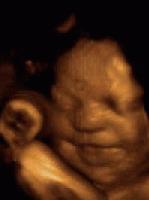 Picture for song 'new era skunk' by artist 'dphi'