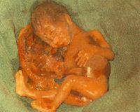 Picture for song 'ABORTO(MADRE SOLTERA)' by artist 'DROGA'