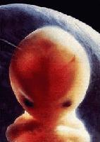 Picture for song 'Born Rotten Growth/Bizarre Creation Begins' by artist 'Elements of Apokalypse'