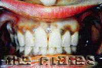 Picture for song 'rd 1 siccology' by artist 'Enoch'