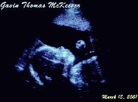 Picture for song 'All For You (Jamil Remix)' by artist 'Esquire of ILL Circle'