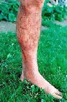 Picture for song 'pissing down your leg' by artist 'e yard'