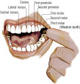 Picture for song 'Got Some Teeth' by artist 'FDR Underground'