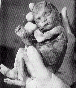 Picture for song 'FINGA' ON DA TRIGGA' by artist 'Fetal Ass Niggas'