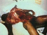 Picture for song 'DAHMER (RIP)' by artist 'FLESHROT'