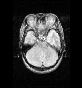 Picture for song 'Total Acid Burn (excerpt)' by artist 'FLOPhOUSE'