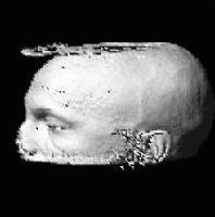 Picture for song 'ANODINE' by artist 'Gun Monkey'