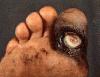 Picture for song 'Kiss Me On The Pinky Toe' by artist 'Guy Friday (ugh)'