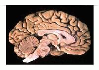 Picture for song 'me with out you' by artist 'IEnquiring Minds'