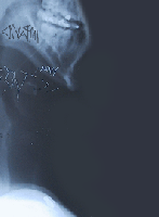 Picture for song 'Timeline' by artist 'Impavid'