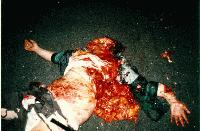 Picture for song 'Ended Torment' by artist 'Intestinal Lynching'