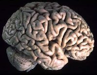 Picture for song 'Got A Big Head' by artist 'Ismael Strom'