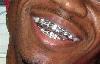 Picture for song 'Time for a Break Draped Up N Dripped Out' by artist 'LilDeuce'