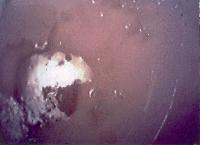 Picture for song 'Sepsis' by artist 'lodemidiquail'