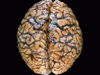 Picture for song 'MasterMind' by artist 'MasterMindz Productionz'