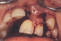 Picture for song 'Night of the Hydraulic Garden Gnomes' by artist 'Masticator'