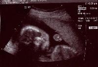 Picture for song 'September 12th' by artist 'Michael Dooley'