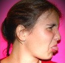 Picture for song 'Choke' by artist 'Mixed Nutz'