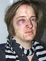 Picture for song 'Another Black Eye' by artist 'Mommy's Little Monster'