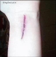 Picture for song 'Opening The Wound' by artist 'Mr Chris'