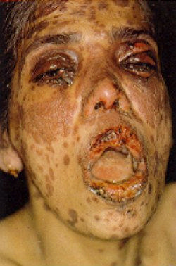 Picture for song 'Yet to be titled anti-Elton John song' by artist 'nxfxtxex'