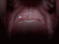 Picture for song 'Glowing Snot' by artist 'Phi'