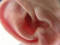 Picture for song 'freckles' by artist 'ralphrubbish'