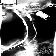 Picture for song 'Kleiner Automat' by artist 'raw : audio'