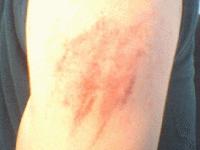 Picture for song 'six' by artist 'ReDefinition'