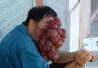 Picture for song '11-Engorged' by artist 'Repulsive Bile'