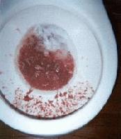 Picture for song '21-Hyperemesis Gravidarum' by artist 'Repulsive Bile'