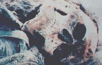 Picture for song '13-Infected Corpse Muncher' by artist 'Repulsive Bile'