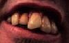 Picture for song 'Éclatage de dents' by artist 'SlaSh BeatZ'