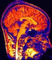 Picture for song 'Eminem/Funky Bass Team Style Beat' by artist 'Sound Dialecct'