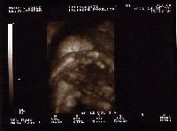 Picture for song 'Friend' by artist 'statboogie'