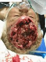 Picture for song 'Heartfelt Orchestra' by artist 'Suburban Circus'