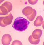 Picture for song 'Sick' by artist 'the Blue Cell'