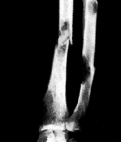 Picture for song 'The Real World' by artist 'The Bonebreaker'