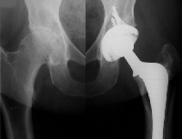 Picture for song 'The Wish' by artist 'The Bonebreaker'