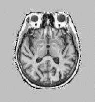 Picture for song 'A Place For Crazy People' by artist 'The Paragon'