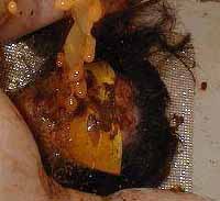 Picture for song 'A Brief Dissertation on the Effects of Tubgirling' by artist 'The Pope'