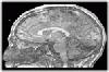 Picture for song 'BRAINS' by artist 'The Specialists'